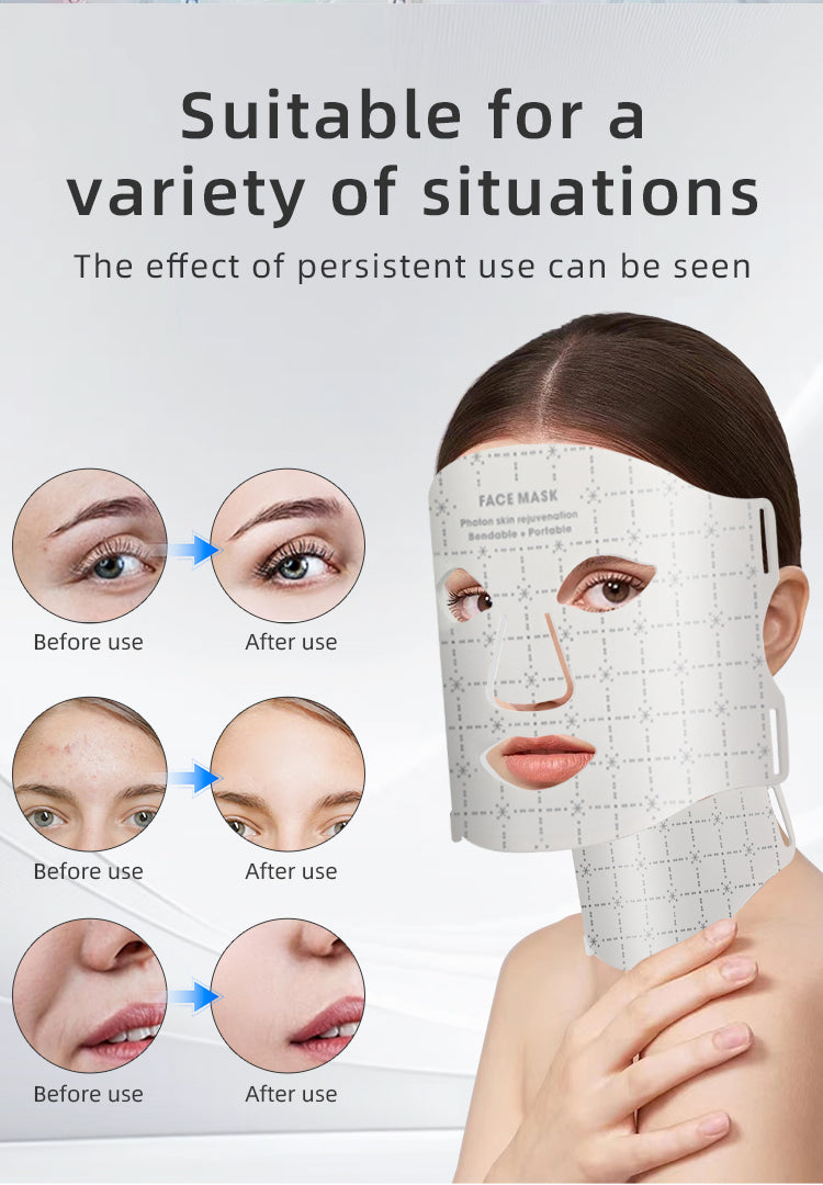 oriday純白七彩LED光面罩＋頸部光療｜三檔能量嫩膚亮白｜食品級矽膠貼合｜香港家用美容神器